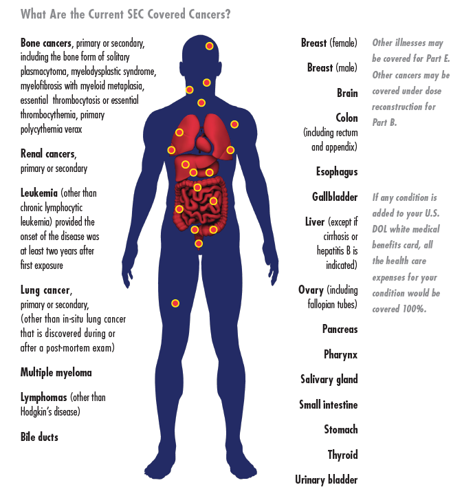 list of covered cancers under the Special Exposure Cohort